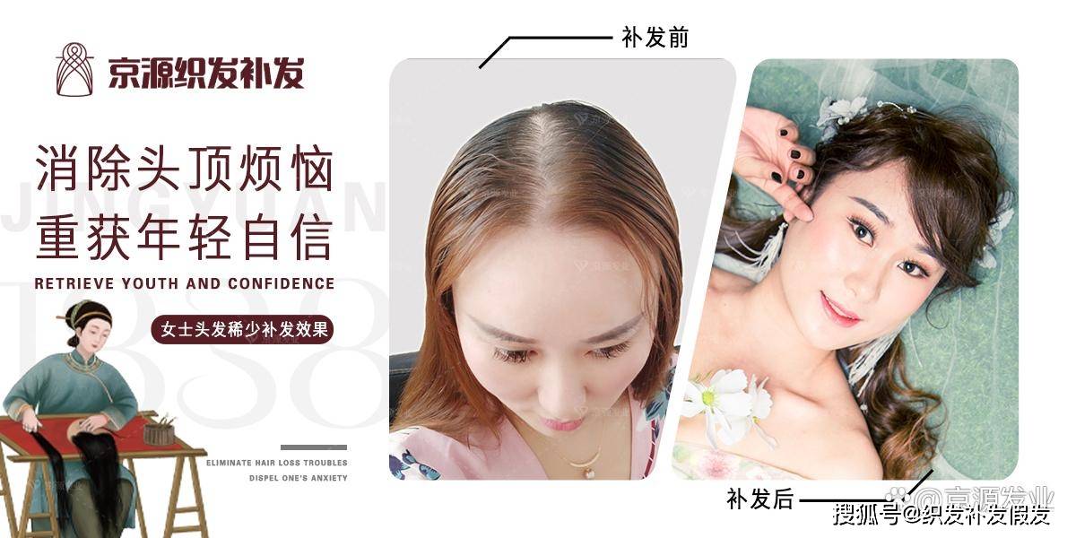 最新织发补发技术详解与步骤指南