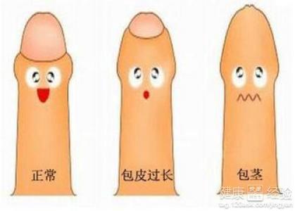 包皮手术价格详解，深入了解与明智选择指南